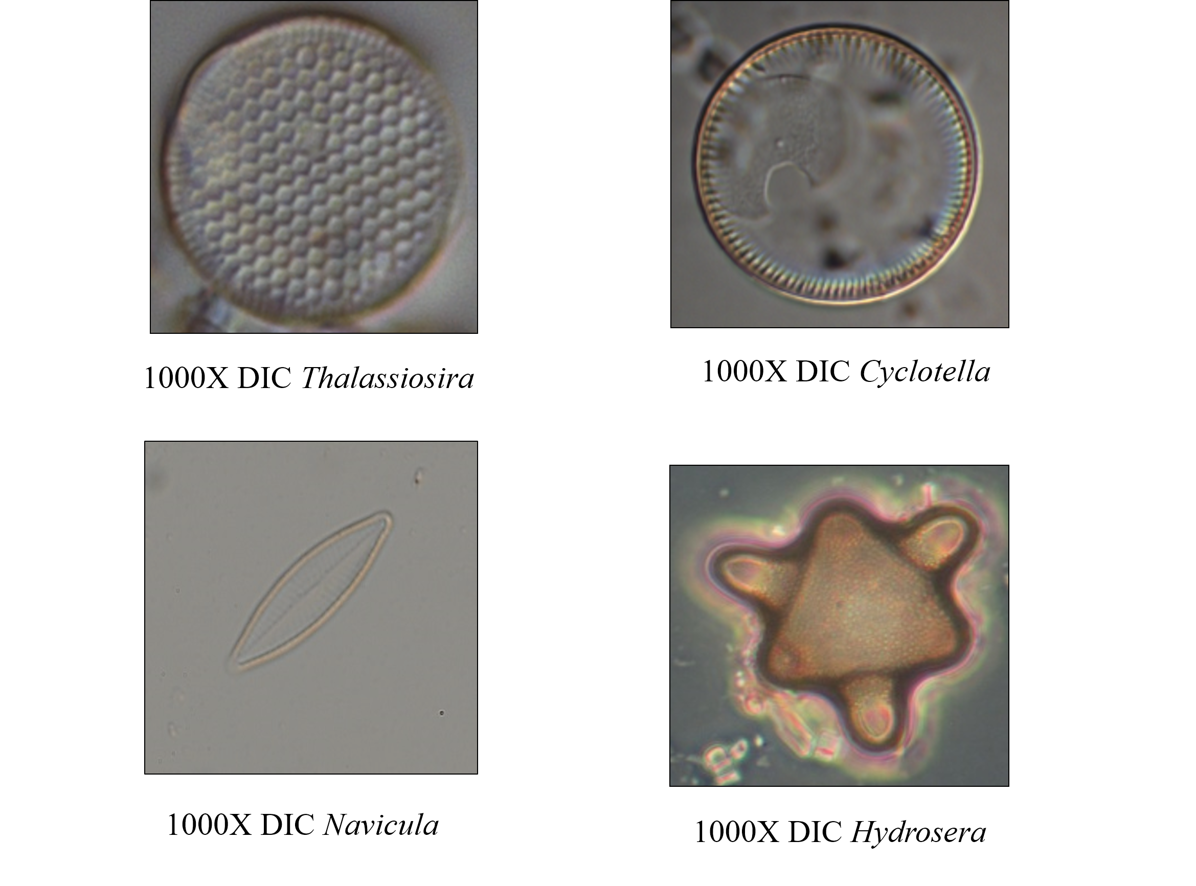 Figure 2：Diatoms under differential interference contrast (DIC) microscope