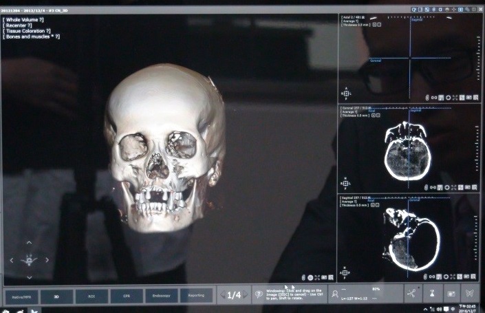 電腦斷層掃描器及3D立體影像重組系統_2(jpg)