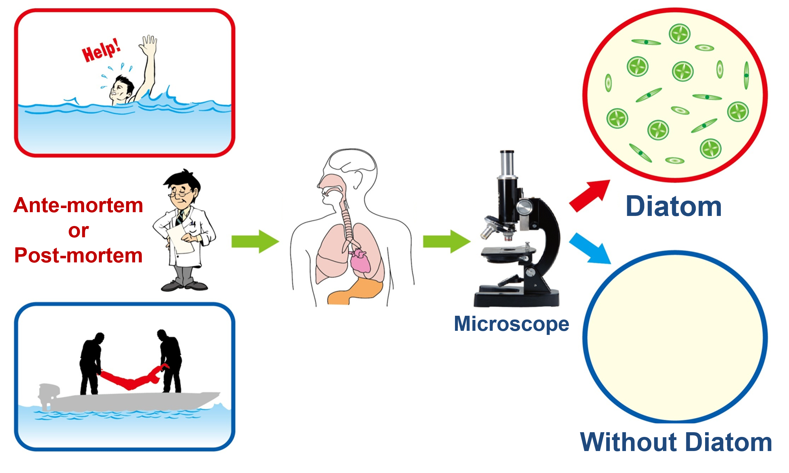 Figure1： General concepts of diatom testing in cause of death investigation